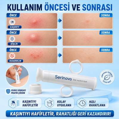 Sinek Böcek Isırık Kaşıntı Önleme Aleti