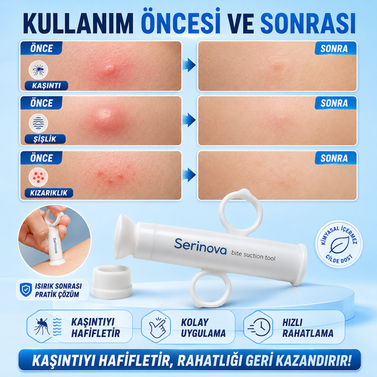 Sinek Böcek Isırık Kaşıntı Önleme Aleti